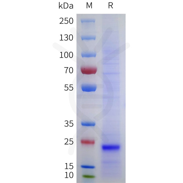 Human TIMP2 Protein, His Tag – Figure 1 of 1