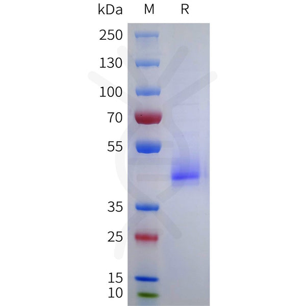 Human ANXA2 Protein, His Tag – Figure 1 of 1