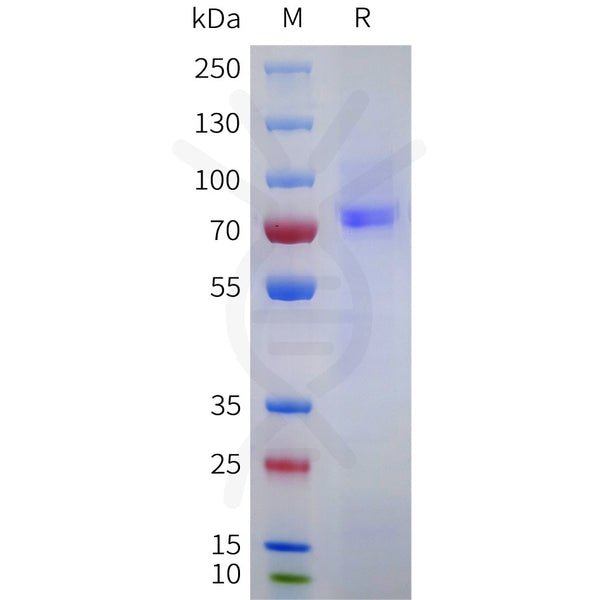 Human EPHA10 Protein, His Tag – Figure 1 of 1