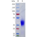 Human SCF Protein, His Tag – Figure 1 of 1