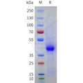 Human CD43 Protein, His Tag – Figure 1 of 1