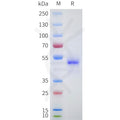 Human LGR5(447-561) Protein, hFc Tag – Figure 1 of 1