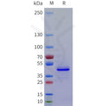 Human REG4 Protein, hFc Tag – Figure 1 of 1