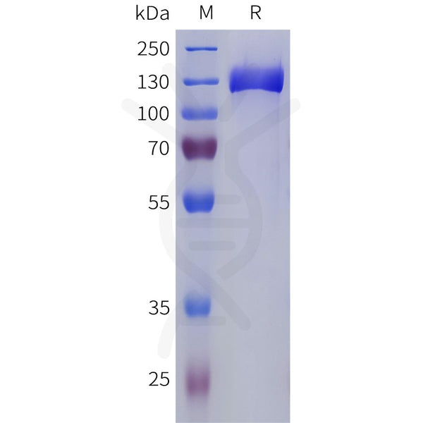 Human CNTN2 Protein, His Tag – Figure 1 of 1