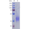 Human LILRA5 Protein, His Tag – Figure 1 of 1