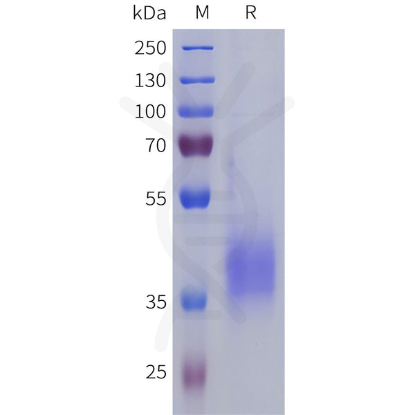 Human LILRA5 Protein, His Tag – Figure 1 of 1