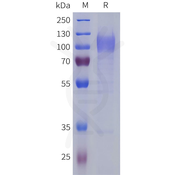 Human LRRC4 Protein, His Tag – Figure 1 of 1