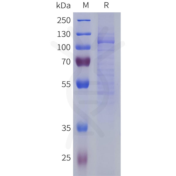 Human IDE Protein, His Tag – Figure 1 of 1