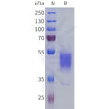 Human PROKR2 Protein, hFc Tag – Figure 1 of 1
