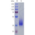 Human PTGFR Protein, hFc Tag – Figure 1 of 1