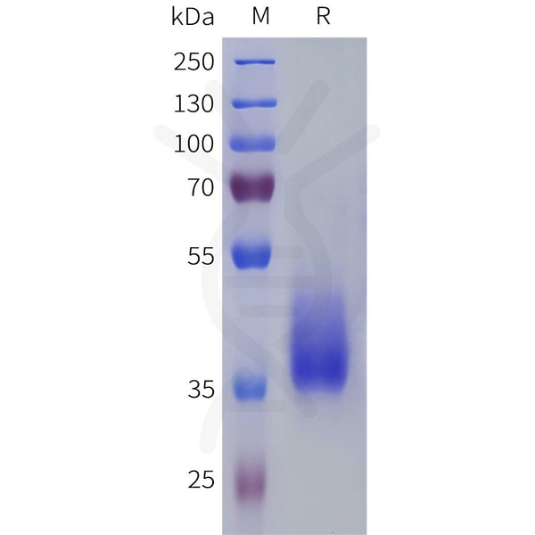 Human PTGFR Protein, hFc Tag – Figure 1 of 1