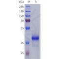 Human S1PR5 Protein, hFc Tag – Figure 1 of 1