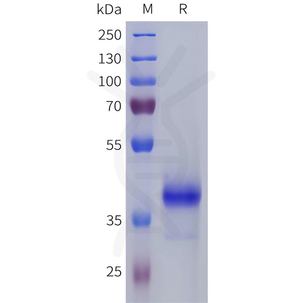 Human S1PR5 Protein, hFc Tag – Figure 1 of 1