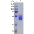 Human VIPR2 Protein, hFc Tag – Figure 1 of 1