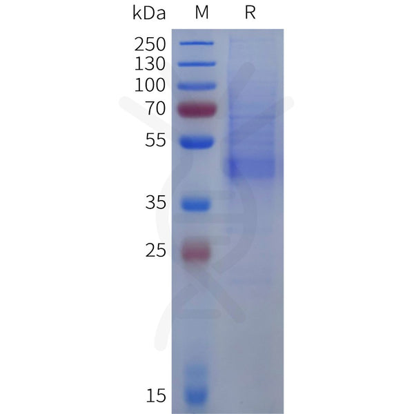 Human DCN(17-359) Protein, His Tag – Figure 1 of 1