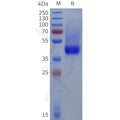 Human DCN(31-359) Protein, His Tag – Figure 1 of 1