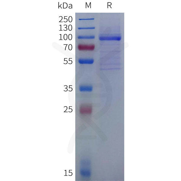 Human OLFML3 Protein, hFc Tag – Figure 1 of 1