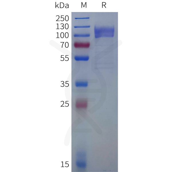 Human IL27RA(33-516) Protein, hFc Tag – Figure 1 of 1