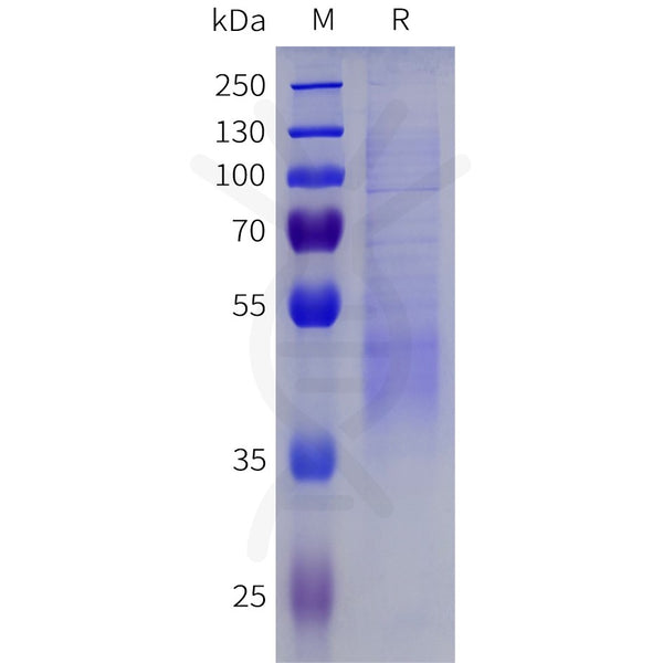 Human IGFBP3 Protein, His Tag – Figure 1 of 1