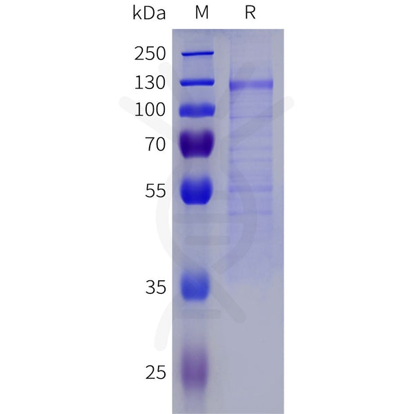 Human KL Protein, His Tag – Figure 1 of 1