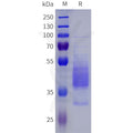 Human NPY1R Protein, hFc Tag – Figure 1 of 1
