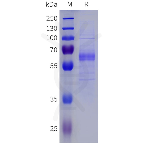 Human IL22RA1 Protein, hFc Tag – Figure 1 of 1
