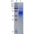 Human GPR37 Protein, His Tag – Figure 1 of 1