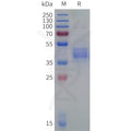 Human ACKR2 Protein, hFc Tag – Figure 1 of 1