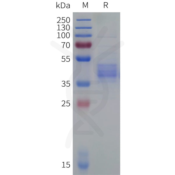 Human ACKR2 Protein, hFc Tag – Figure 1 of 1