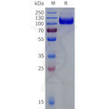 Human B7-H3(27-461) Protein, hFc Tag – Figure 1 of 1