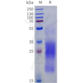Human MUC17(4131-4390) Protein, His Tag – Figure 1 of 1