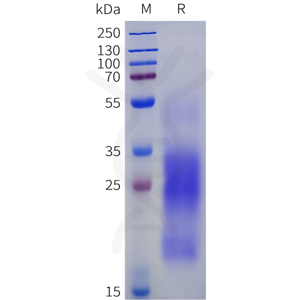 Human MUC17(4131-4390) Protein, His Tag – Figure 1 of 1