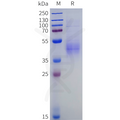 Human IL20RA Protein, His Tag – Figure 1 of 1