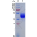 Human MC5R Protein, hFc Tag – Figure 1 of 1
