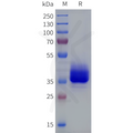 Human LPAR3 Protein, hFc Tag – Figure 1 of 1