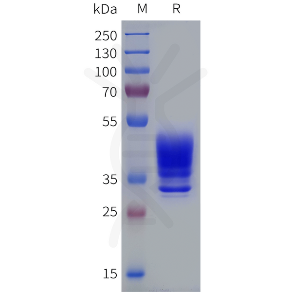Human LTB4R Protein, hFc Tag – Figure 1 of 1