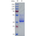 Human HTR2B Protein, hFc Tag – Figure 1 of 1