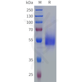 Human SIGLEC6 Protein, His Tag – Figure 1 of 1