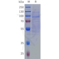 Human SLITRK6 Protein, His Tag – Figure 1 of 1