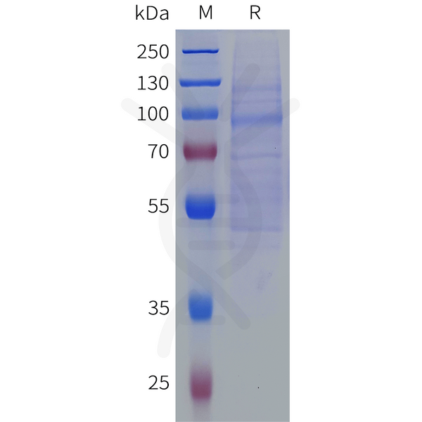 Human SLITRK6 Protein, His Tag – Figure 1 of 1