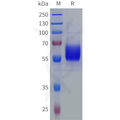 Human EPO Protein, hFc Tag – Figure 1 of 1