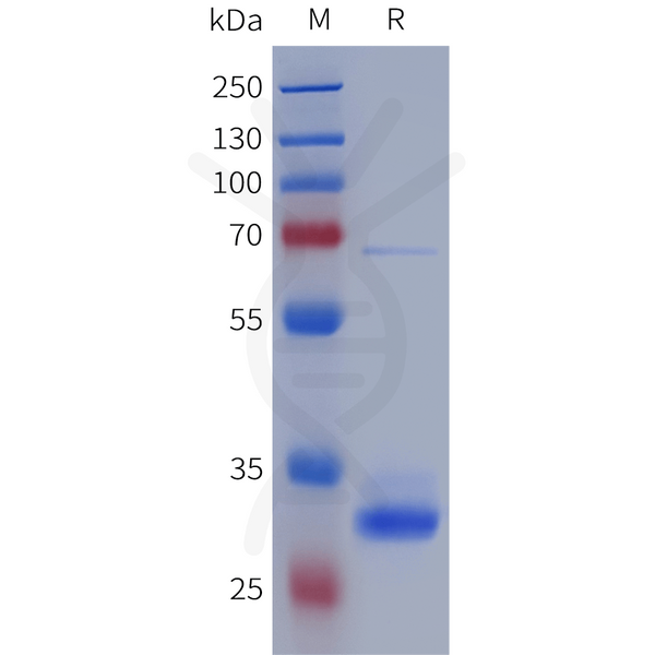 Human IGFBP4 Protein, His Tag – Figure 1 of 1