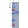 Human EGFR(446-621) Protein, hFc Tag – Figure 1 of 1