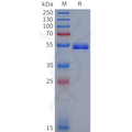 Human MMP1 Protein, His Tag – Figure 1 of 1