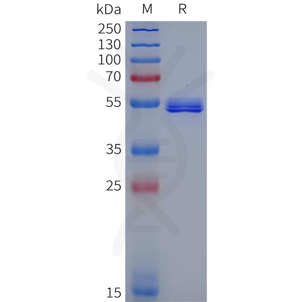 Human MMP1 Protein, His Tag – Figure 1 of 1