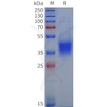 Human KIR2DL5A Protein, His Tag – Figure 1 of 1