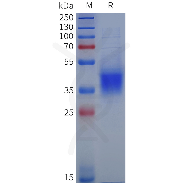 Human KIR2DL5A Protein, His Tag – Figure 1 of 1