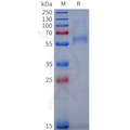 Human VWF(764-1238) Protein, N-His Tag – Figure 1 of 1