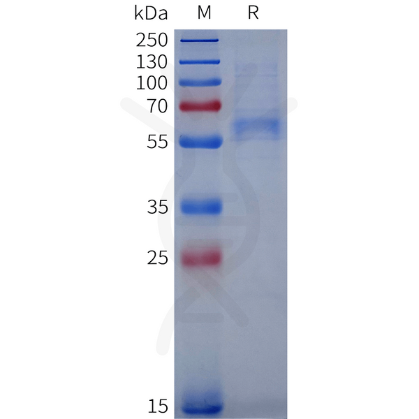 Human VWF(764-1238) Protein, N-His Tag – Figure 1 of 1