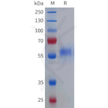 Human VWF(764-1238) Protein, C-His Tag – Figure 1 of 1
